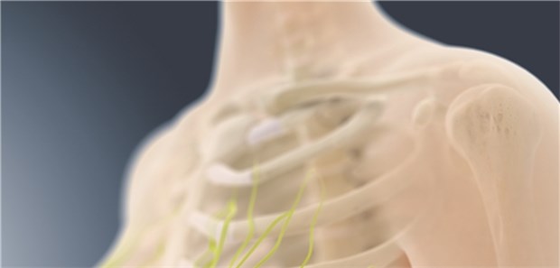 Brustkrebs: Metformin könnte antiproliferative Effekte entfalten.