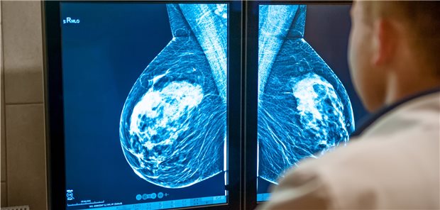 Brustkrebsscreening: Adipöse Frauen könnten von kürzeren Screeningintervallen profitieren.