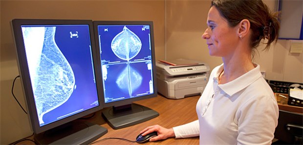 Brustkrebsvorsorge: In ihrem Statistikmodell bezogen die Forscher betsimmte Genmarker in die Berechnungen ein.