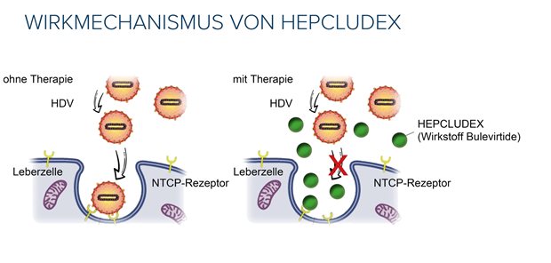 Wirkmechanismus von Hepcludex gegen Hepatitis-D-Viren