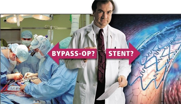Stent oder Bypass? Die Diskussion geht weiter Bypass oder Stent - das ist bei komplexen Koronarstenosen häufig die Frage.