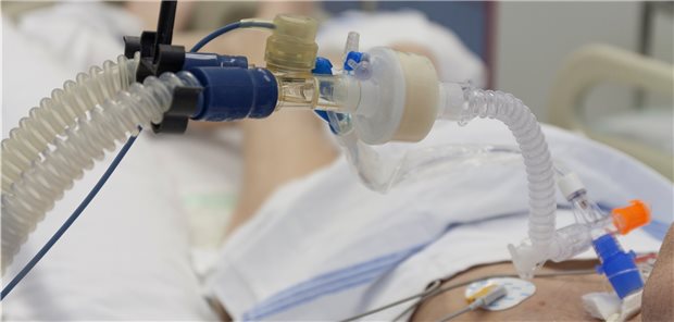 COVID-19-Patienten mit einem NIV-Versagen, die deshalb sekundär intubiert werden mussten, hatten einer Analyse zufolge sehr schlechte Überlebenschancen.