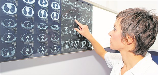 CT-Angiografie oder Magnetresonanzangiografie zur Abklärung einer Lungenembolie? Der Frage sind Forscher in einer retrospektiven Studie nachgegangen.