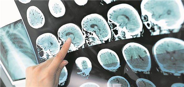 CT-Bilder vom Kopf: Die Suche nach auffälligen Befunden kann auch eine Künstliche Intelligenz übernehmen. Doch was, wenn das Programm sich einmal verrechnet? Wer haftet für die Fehldiagnose?