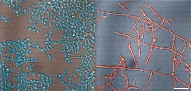 Candida albicans in seiner harmlosen (links) und seiner infektiösen (rechts) Form.