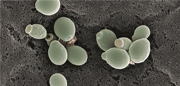 Elektronenmikroskopische Aufnahme von Candida albicans.