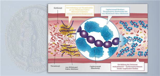 Caplacizumab blockiert die Thrombozyten-Bindungsstelle an den von-Willebrand-Faktor-Multimeren, sodass die Bildung von Mikrothromben mit konsekutiver Organischämie verhindert wird.