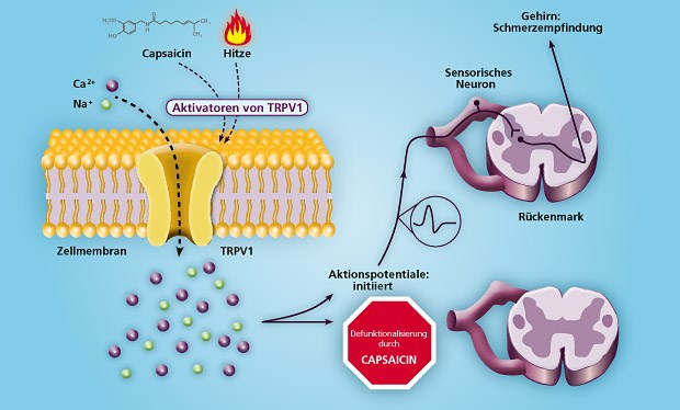 Capsaicin (Qutenza™) aktiviert den TRPV1-Kanal, was letztlich die hyperaktiven Schmerzfasern hemmt.