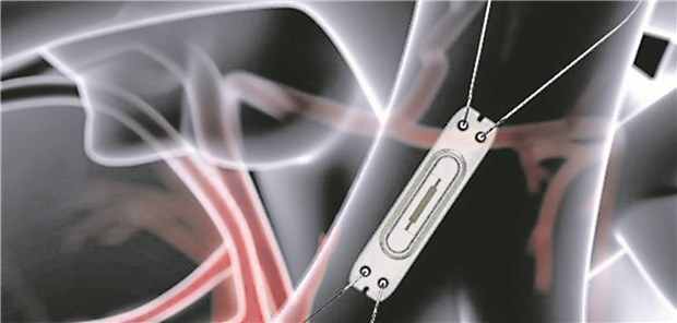CardioMEMS-Implantat zum Telemonitoring bei Herzinsuffizienz: Der Drucksensor wird über die V. femoralis direkt in der Pulmonalarterie platziert.