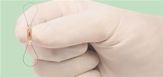 CardioMEMS-Implantat zum Telemonitoring bei Herzinsuffizienz.