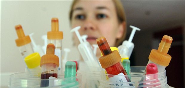 Check des Natrium-Spiegels: Bei Werten zwischen 130 und 135 mmol/l spricht man bereits von einer leichten Hyponatriämie.