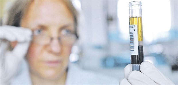 Schadet PSA-Screening mehr als es nutzt? Chemikerin bei der PSA-Wertbestimmung im Labor. Der Nutzen eines PSA-Screenings zur Früherkennung von ProstataKarzinom wird weiterhin sehr kontrovers diskutiert.