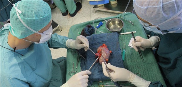 Chirurgen im OP mit einer Spenderniere. Ein aktuelles BGH-Urteil führt zu Diskussionen.