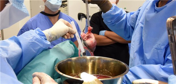 Zweiter Patient mit Schweineherz gestorben Chirurgen im University of Maryland Medical Center in Baltimore bereiten sich auf eine Schweineherz-Transplantation vor: Nach der weltweit ersten erfolgreichen Transplantation im Jahr 2022 führte dasTeam im September 2023 eine zweite Schweineherztransplantation bei einem Patienten durch.