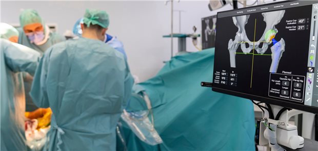 Chirurgen setzen einen künstlichen Hüftgelenkersatz ein. Die Wahl der Methode beeinflusst wohl auch, welche Beschwerden die Patienten aufgrund der Totalendoprothese haben.