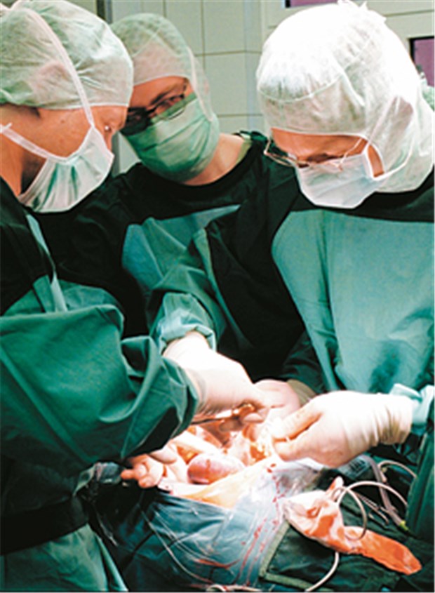 Wie Steinmeier spenden viele Menschen zu Lebzeiten eine Niere Chirurgen transplantieren eine Niere.