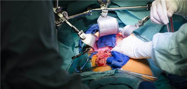Chirurgen während einer Lebertransplantation.