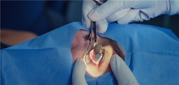 Chirurgie am Auge: Die Trabekulektomie gilt bei Glaukom nach wie vor als Goldstandard, es gibt aber inzwischen alternative Verfahren.