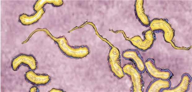 WHO bereitet 900.000 Cholera-Impfungen vor Cholera-Erreger: Die WHO rüstet sich gegen eine Epidemie mit hunderttausenden Impfungen.