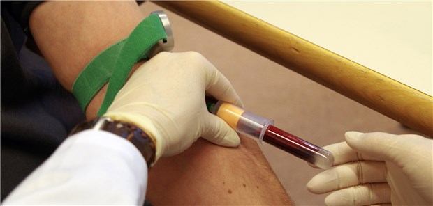 Cholesterin-Bestimmung direkt nach den Feiertagen: Die Ergebnisse könnten in die Irre führen.