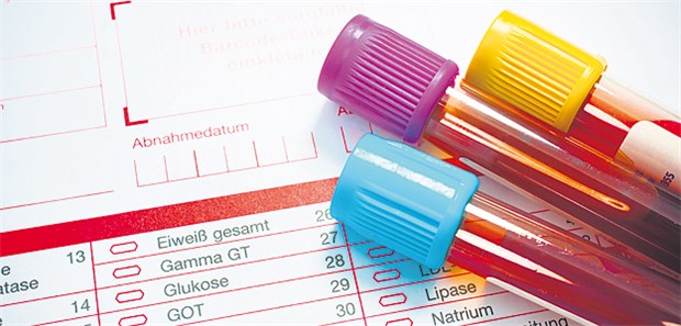 Ist die Therapie ohne Zielwert ziel- und wertlos? Cholesterin-Messung: Ist sie noch nötig, wenn Cholesterin-Zielwerte obsolet sind?