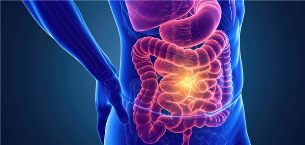 Colitis ulcerosa: Häufiger klinische Remission mit Risankizumab Crohn's disease Inflammatory bowel disease causing abdominal pain and digestive issues, AI Generated