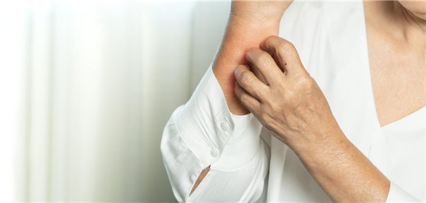 Eine ältere Frauen kratzt sich aufgrund eines chronischen Pruritus am Arm.