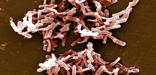 Clostridium difficile (im Rasterelektronenmikroskop) ist weiterhin der wichtigste Erreger nosokomialer Diarrhoen in Deutschland.