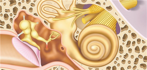 Cochleäre Störungen treten bei Patienten mit Migräne rund dreimal häufiger auf als bei Kontrollpersonen ohne Migräne.
