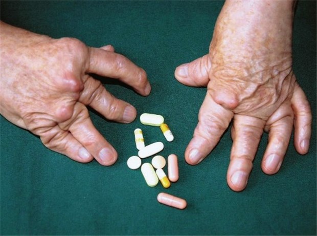 Wenn das System extreme Brüche hat, kann auch Compliance nicht funktionieren Compliance - ein Kernproblem von vielen Patienten mit einer rheumatoiden Arthritis.