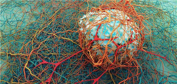 Computer-Darstellung einer Krebszelle. Neuerkrankungen an Darmkrebs lassen sich offenbar mit Vorsorge-Koloskopien effektiv reduzieren.