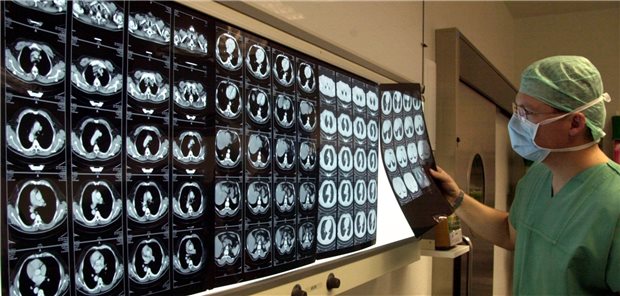 Computertomographische Thorax-Aufnahmen: Bei Patienten mit klinischen T1aN0-Tumoren und intraoperativ bestätigtem N0-Status genügt die sublobäre Resektion.