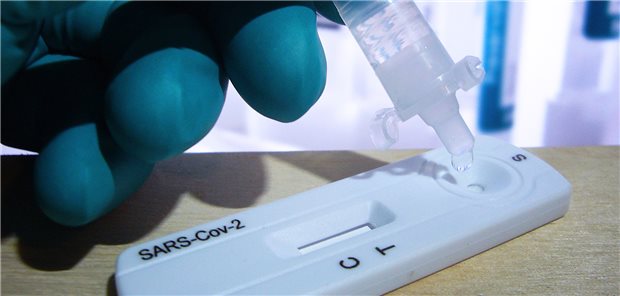 KV rät von Schnelltests bei symptomlosen Patienten ab Corona-Schnelltest. Mit der neuen Corona-Testverordnung gibt es den kostenfreien Bürgertest nur noch für bestimmte Ausnahmefälle. Das bedeutet mehr Kontrollbürokratie für Praxen.