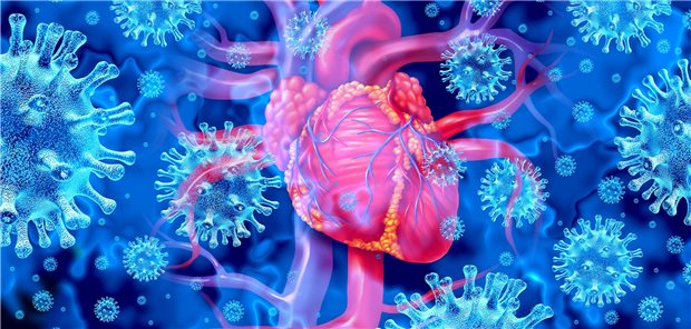 Corona und Herz im Fokus: Die Inzidenz von Myokarditis und Perikarditis nach COVID-Impfung ist wohl insgesamt gering und sie ist auch geringer als nach einer COVID-19-Erkrankung.