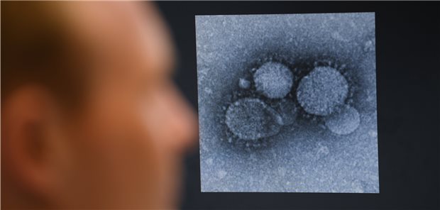 Virologen kritisieren KBV-Position zum Lockdown MERS-Coronaviren unterm Elektronenmikroskop
