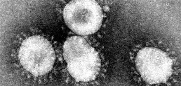 Erster Toter nach Infektion mit neuem Coronavirus Coronaviren unter dem Elektronenmikroskop: Wie gefährlich ist der neue Typ in China?
