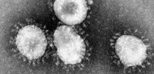 Stammt MERS aus Afrika? Coronavirus unter dem Elektronenmikroskop.