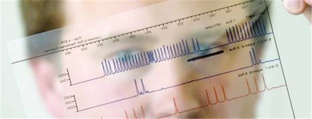 Koalition ebnet Weg für ein Gendiagnostikgesetz DNA-Analysen geben Aufschluss über die genetische Veranlagung eines Menschen. Von Versicherungen werden sie bislang nicht berücksichtigt.