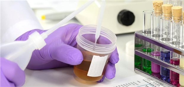 Untersuchung des Urins