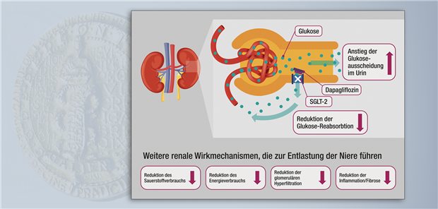 Dapagliflozin bewirkt nicht nur eine vermehrte Glukoseausscheidung über den Urin, sondern triggert auch weitere renale Wirkmechanismen, was insgesamt zu einer Entlastung und somit zum Schutz der Nieren führt.
