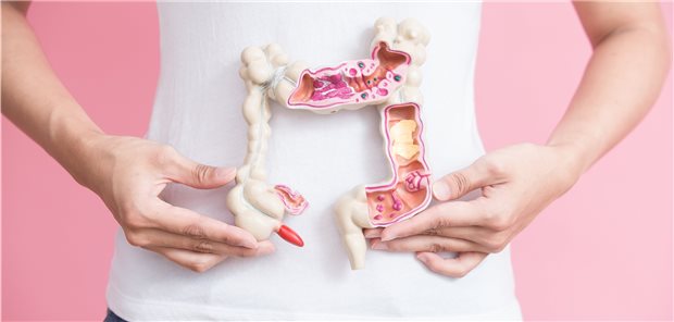 Darmkrebs im Modell: Das Reduzieren zuckerhaltiger Getränke bei jungen Erwachsenen könnte helfen, die steigende Inzidenz früh auftretender kolorektaler Karzinome zu verringern.