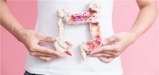 Darmkrebs im Modell: Diabetiker mit solchen Karzinomen profitieren offenbar von einer gewissenhaften Blutzucker-senkenden Therapie mit Metformin.