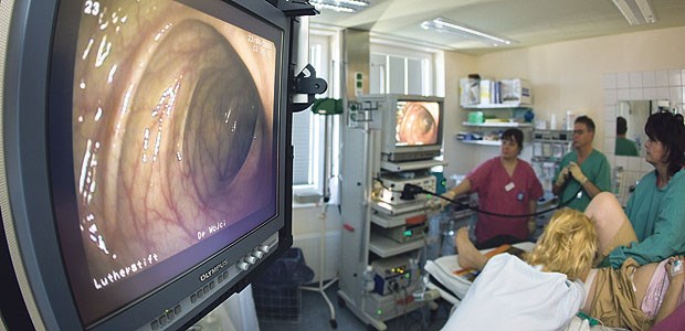 Koalition bläst zum Kampf gegen Krebs Darmspiegelung bei einer Patientin: Die Bundesregierung will mit einem Einladungsverfahren die Teilnahmerate an der Früherkennung erhöhen.