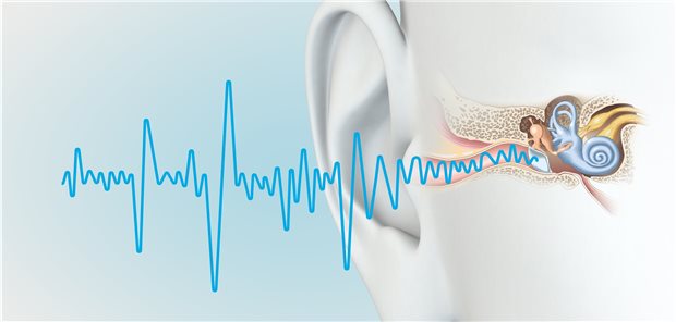Darstellung des menschlichen Hörorgans: Vestibularisschwannome sind gutartige Tumore, die vom Nervus vestibularis ausgehen und meist ab einem Alter von etwa 50 Jahren einseitig auftreten.