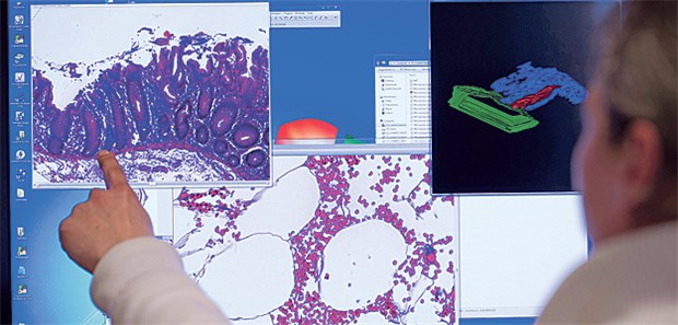 Lob und Tadel zur Halbzeit Darstellung einer eingescannten Probe eines Stück Gewebes aus dem Dickdarm.. Die Analyse registrierter Daten klinischer Krebsregister ermöglicht Rückschlüsse auf Therapieerfolg und Qualität der Behandlung.