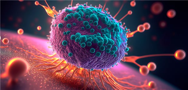 Darstellung eines Karzinoms: Bei der Behandlung von Patienten mit Prostata-Karzinomen punktete Rucaparib in einer Studie.