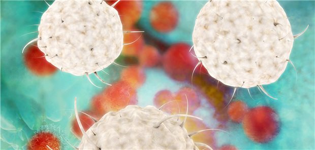 Neuer Therapieansatz gegen Sepsis Darstellung von Leukozyten. Die häufigsten Leukozyten, die neutrophilen Granulozyten, lassen sich mit Acetat auf Trab bringen, haben Tübinger Forscher entdeckt.