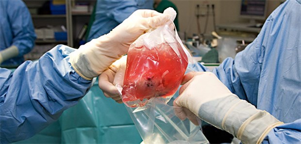 Das Abkühlen des Transplantats könnte dazu beitragen, die Akzeptanz nicht optimaler Spender zu erhöhen.