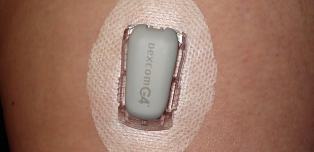 Medizintechnik-Trends aus der Wüste Das Blutzucker-Management-System Dexcom G4 wird wie ein Pflaster am Körper getragen. Ein Sensor mit einer kurzen Nadel liefert die Daten.
