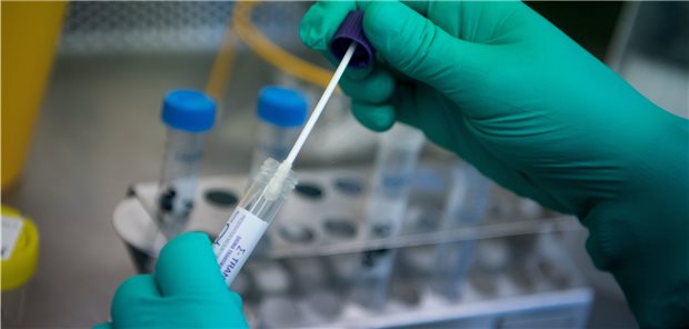 Hamburger Hausärzteverband ist gegen mehr Coronatests Das Bundesinnenministerium denkt über eine Coronavirus-Testoffensive nach.